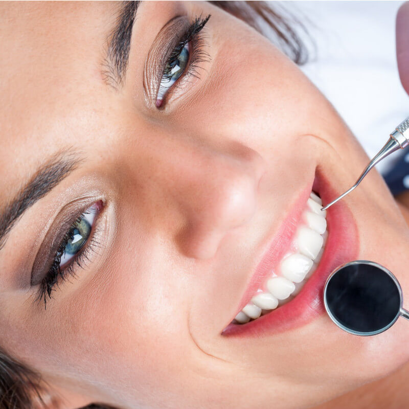 Lente de Contato Dental no Rio de Janeiro