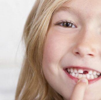 Menina perdeu dente mole