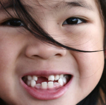 O dente do meu filho não nasce