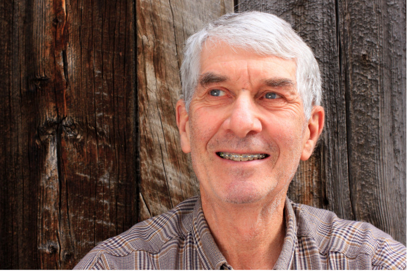 O Tratamento ortodôntico pode ter algumas limitações em adultos