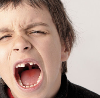 dente de leite quebrado tem conserto